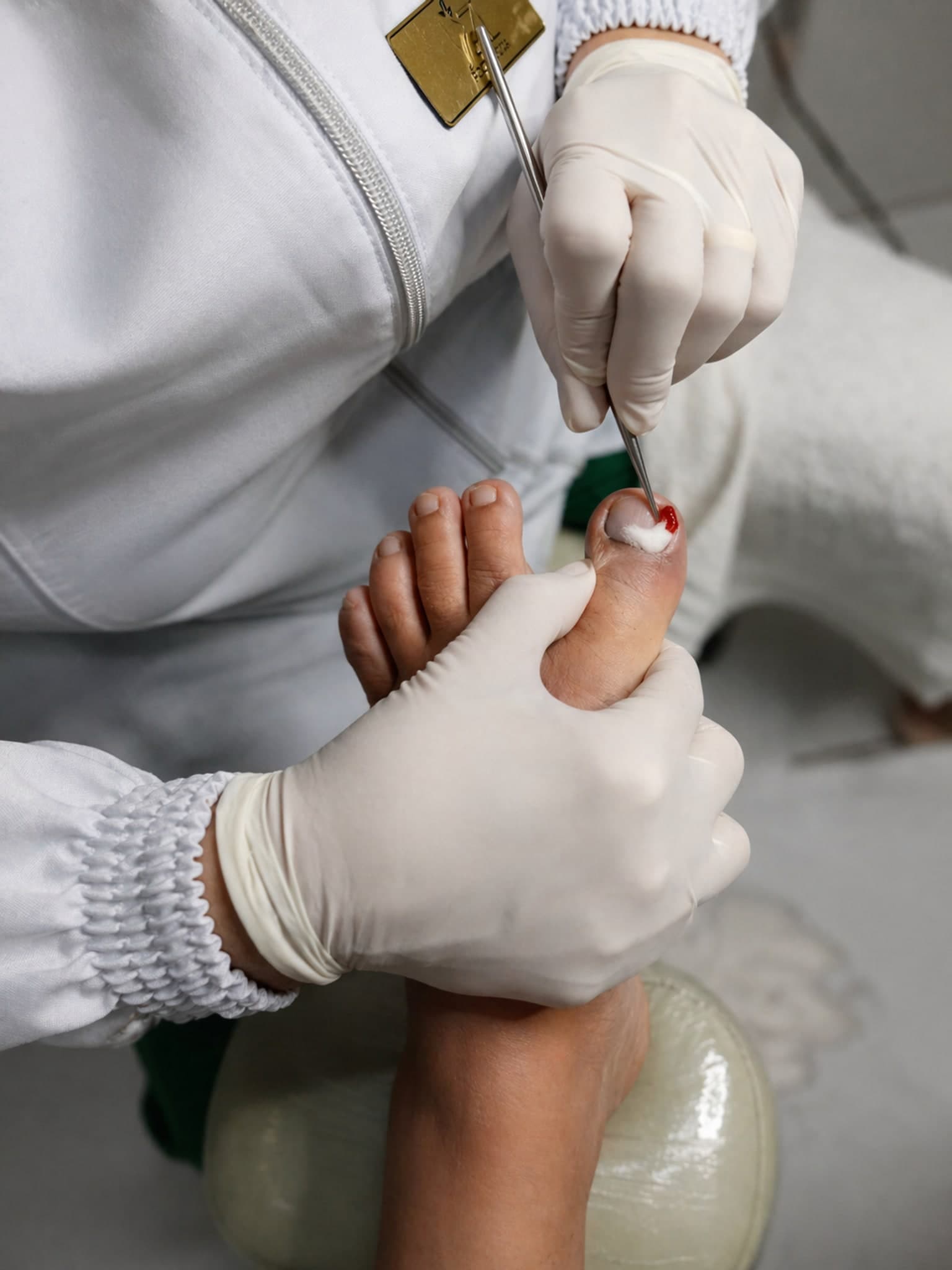 Cuidado podológico sensível para pés na ZL Podologia Fortaleza