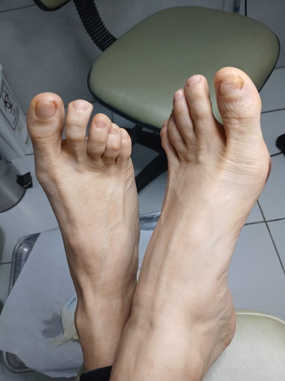 Registro autorizado de acompanhamento de protocolo para fungo na unha